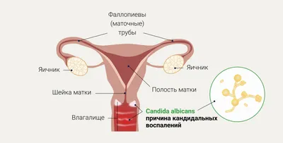 Candida albicans: грибы, связанные заболевания, лечение