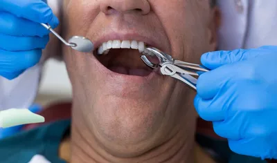 Шатается коренной зуб, болит зуб, гноится десна? Скрипите во сне зубами?  Основные симптомы стоматологических заболеваний