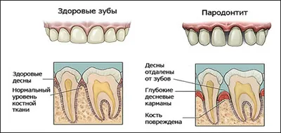 Рекомендации после приёма хирурга-стоматолога / Хабр