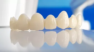 Имплантация зубов, безметалловая керамика на каркасах из циркония. —  Примеры работ — Стоматология Элита