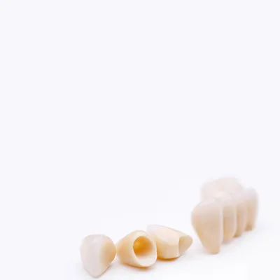 Placing ceramic crowns in Saint Petersburg | Axioma Dental