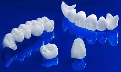 Безметалловые коронки E-max в Минске | Стоимость изготовления коронок из  керамики Emax