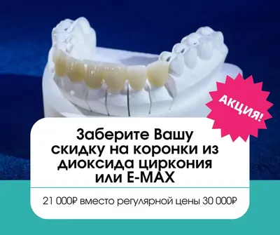 Безметалловые коронки - Ivory - стоматологическая лаборатория