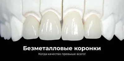 Керамические коронки на зубы в Казани. Цены на фарфоровые коронки