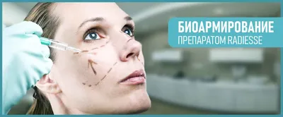 Elena Bassel clinic - Биоармирование лица: процедура подтяжки кожи без  нитей! Это инновационный способ моделирования овала лица. С помощью  специальных игл- канюль, определённым линейным методом в кожу вводится  препарат, который создаёт биологические