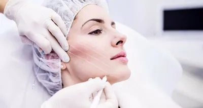 medline_cosmetology - Биоармирование в @medline_cosmetology🌿 Биоармирование  - это безоперационная методика коррекции и подтяжки лица. Это  косметологическая процедура , проводимая с помощью инъекции. Такая  коррекция способна приостановить изменения ...