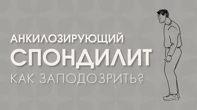 Лечение болезни Бехтерева в клинике «Доктор Позвонков» - Доктор Позвонков