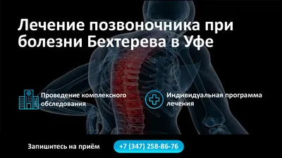 Болезнь Бехтерева - Нейрохирургия Киев