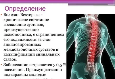 Анкилозирующий спондилит или Болезнь Бехтерева