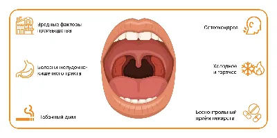 Болезни горла: виды и причины, хронические и инфекционные заболевания  горла, симптомы, читайте в статье блога Furasol®