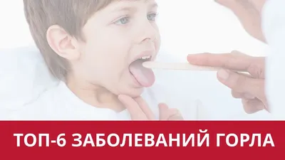 ТОП-6 детских заболеваний горла | Школа здоровья МЕГИ