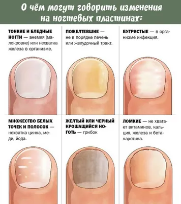 Названы опасные болезни, при которых синеют ногти - Газета.Ru | Новости