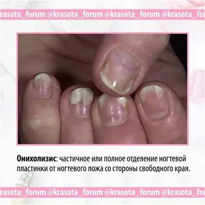 EcoStet Пособие по маникюру Заболевания ногтей