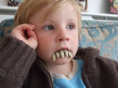 Отчего у детей плохие молочные зубы? 10 мифов и чистая правда | verona-mama  | Дзен