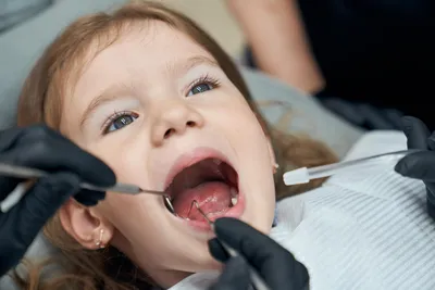 У ребенка болит зуб: что делать❓ - Евромед Дентал