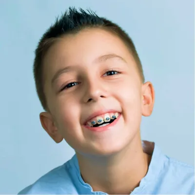 Больные зубы у детей фото фотографии