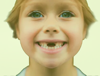 У ребенка гнилые зубы – статьи детской стоматологической клиники «Мартинка»