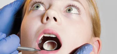 Зубы молока детей. Взрослые зубы растут сверху на фронт Стоковое Фото -  изображение насчитывающей возникновения, людск: 180847454