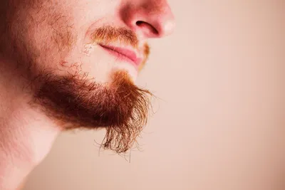 Что делать, если не растет борода? Советы