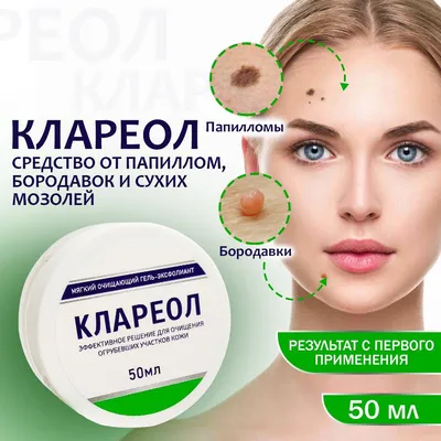 Крем-гель от бородавок и папиллом, сухих мозолей, трещин Клареол ТМ Атриум  - купить с доставкой по выгодным ценам в интернет-магазине OZON (1000923595)