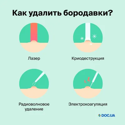 Как убрать бородавку, способы вывести, удалить бородавку в домашних условиях
