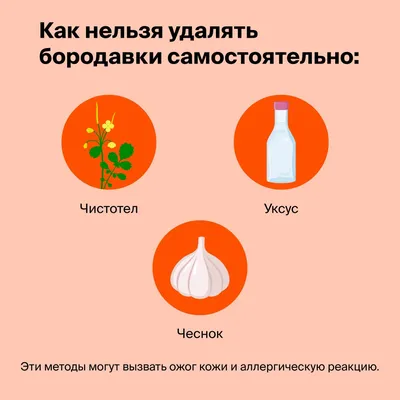 Удаление папиллом (бородавок) ᐉ Цена хирургического удаления папиллом в  Полтаве • Отзывы пациентов из Киева и Харькова