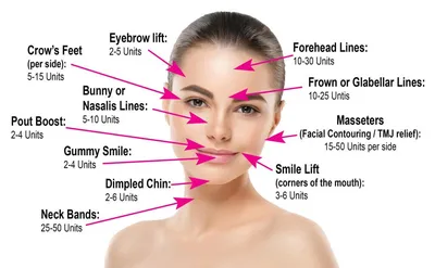 How Botox Re-Shaped the Face of Beauty