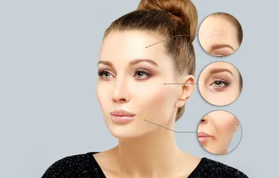 Does Botox Hurt? What Does It Really Feel Like? An Honest Account... |  Glamour UK