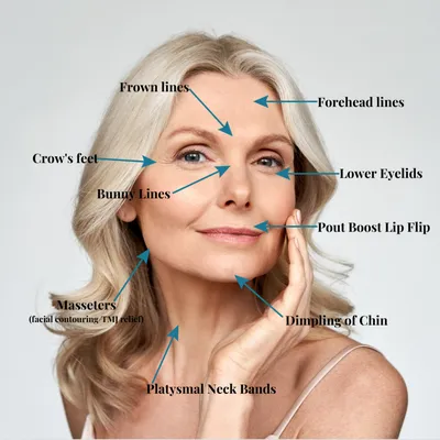 Why Who Administers Your Botox® Matters: Allure Dermatology: Dermatologists