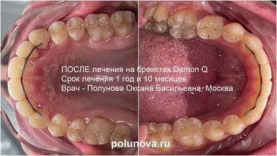 Ортодонтия | Стоматология в Запорожье Dental Studio