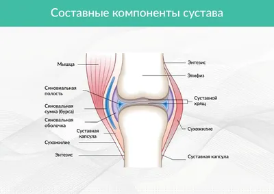 Бурсит коленного сустава – причины, симптомы, диагностика и лечение в  клинике «Будь Здоров»