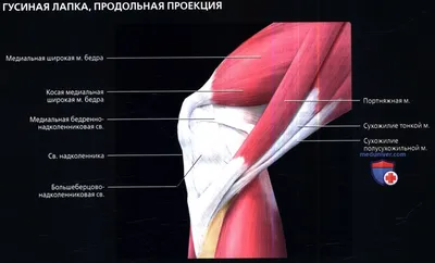 Бурсит «гусиной лапки» - KinesioPro