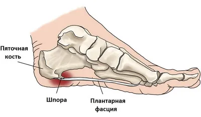 Боль в колене: самые распространенные заболевания | KENMED.ru | Дзен