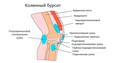 Клиника и диагностика синдрома «Гусиной лапки» – тема научной статьи по  клинической медицине читайте бесплатно текст научно-исследовательской  работы в электронной библиотеке КиберЛенинка