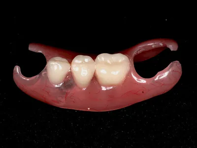 Частично съемный зубной протез на верхнюю и нижнюю челюсть, цена 9900р
