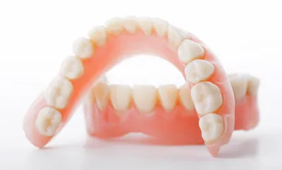 Бюгельный зубной протез на верхнюю челюсть - Центр приватной стоматологии  «Доктор Левин»
