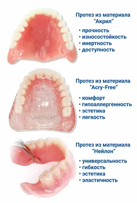 Съёмные протезы