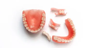 Протезирование верхних зубов, варианты и стоимость от 12 000 ₽
