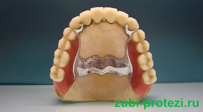 Частично съемный протез зубов в Москве стоимость установки в  стоматологической клинике Элайнер.рф