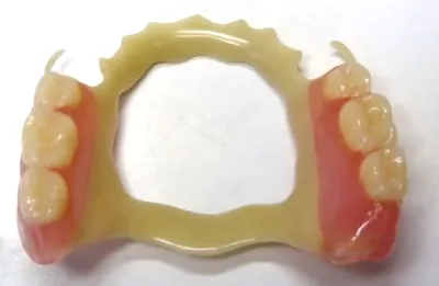 Верхний зубной протез: цена, виды протезов на верхнюю челюсть | НоваДент