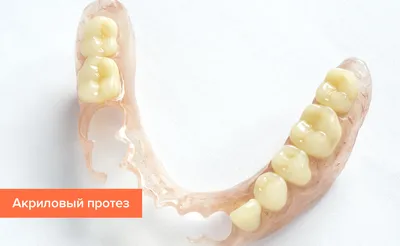 Съемные зубные протезы – цена, виды, без неба, фото, отзывы