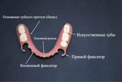 Частичный съемный зубной протез - Центр приватной стоматологии «Доктор  Левин»