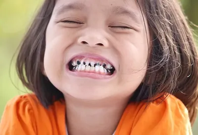 Передаются ли по наследству «плохие зубы» – статьи детской  стоматологической клиники «Мартинка»