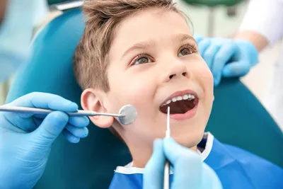 Лечение кариеса у детей — как лечат кариес молочных и постоянных зубов