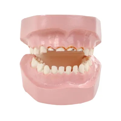 Лечение зубов у детей в Смоленске в стоматологии Family Smile, цены на  процедуры