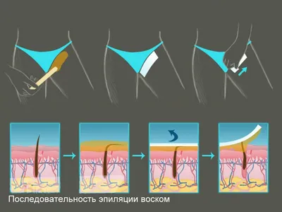 Депиляция подмышечных впадин воском Italwax / Venko.com.ua - YouTube