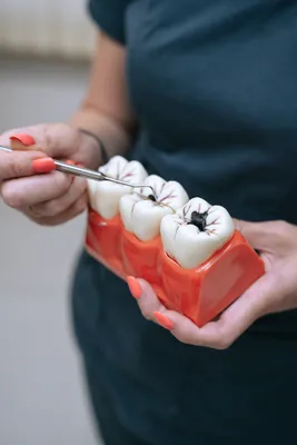 Контактный кариес молочных зубов: профилактика и лечение в СПб