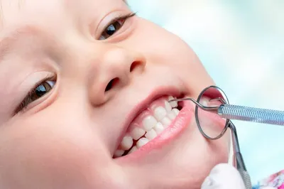 Черные молочные зубы: виды, причины, лечение | СКАЙКЛИНИК