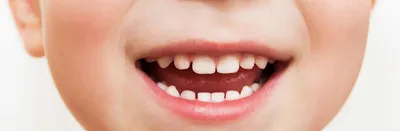 Лечение зубов у детей | молочные зубы и кариес у детей