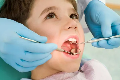 Лечение детского кариеса в Калининграде — стоматология Genesis
